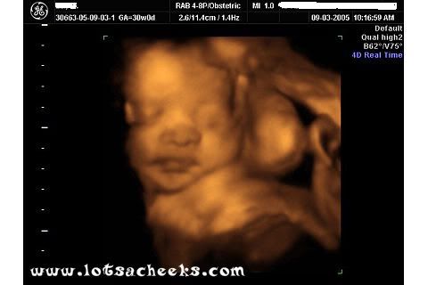 3d ultrasound scan. of Belle#39;s ultrasound scan