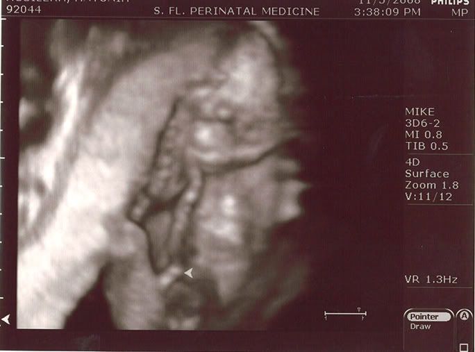 sonogram 5 weeks. 4D image done just 5 weeks