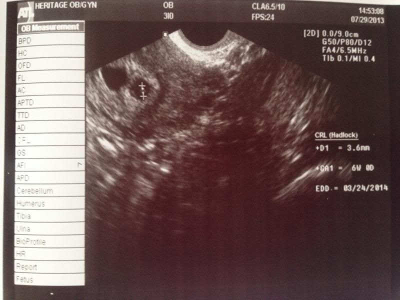 6w0d ultrasound shocker babycenter photo photo1 jpg